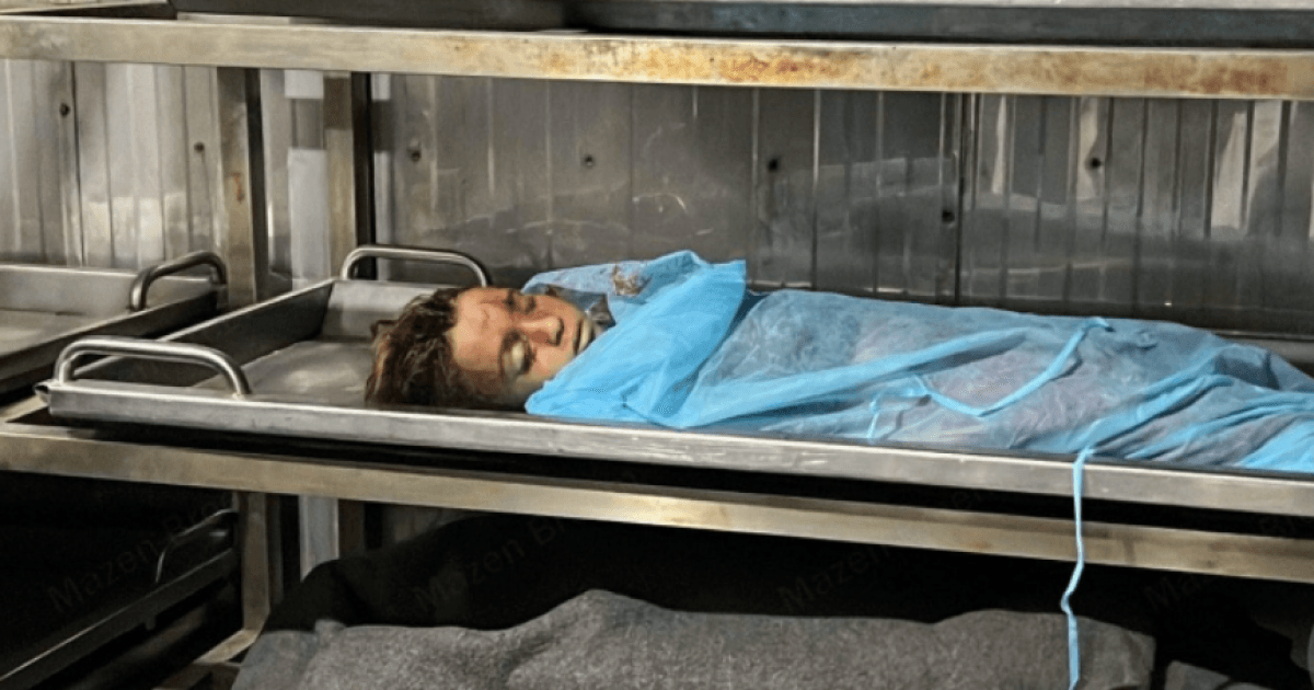 7 شهداء و21 إصابة خلال 24 ساعة في غزة